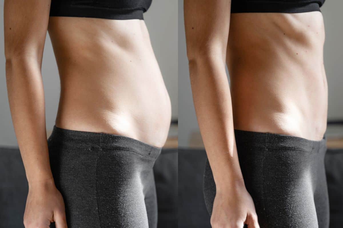 Post-Pregnancy: What Happens to Your Abdominal Muscles After Birth Plaistow