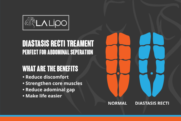 When to Be Concerned About Abdominal Muscle Changes Plaistow