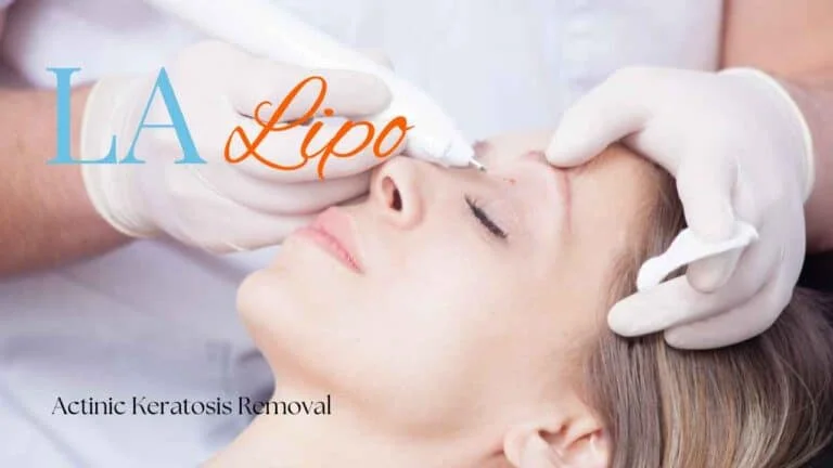 Woman receiving Actinic Keratosis Removal Treatment Plaistow