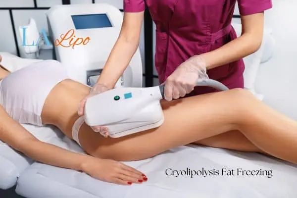 Woman receiving coolsculpting Plaistow treatment on her thighs