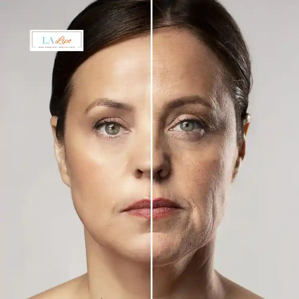 How Can You Tell If Non-Surgical Skin Tightening Is Right for You Plaistow?