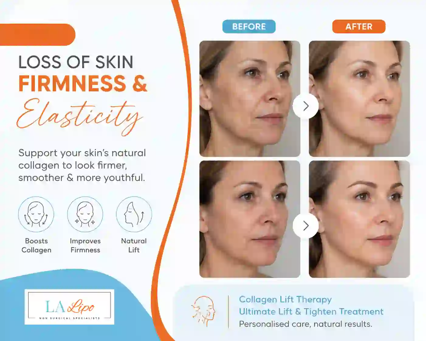 Sign #7: Loss of Skin Firmness and Elasticity Plaistow